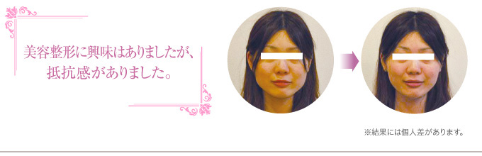 美容整形に興味はありましたが、抵抗感がありました。